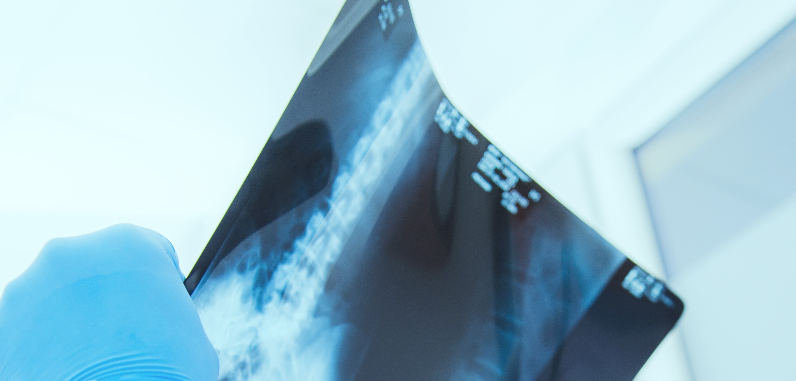 an x-ray of a spine