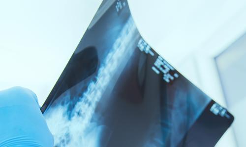 an x-ray of a spine